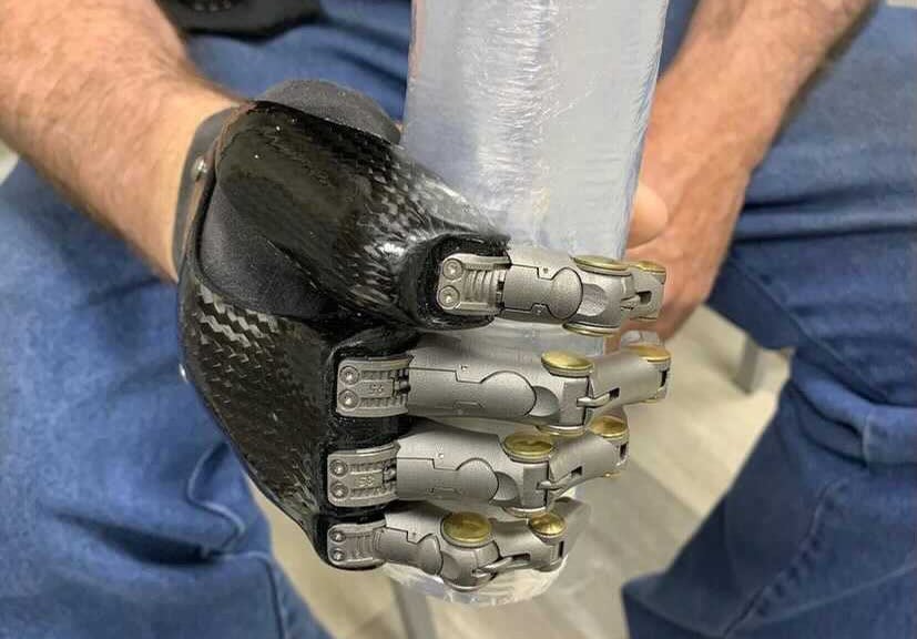 Point Designs patients with prosthesis